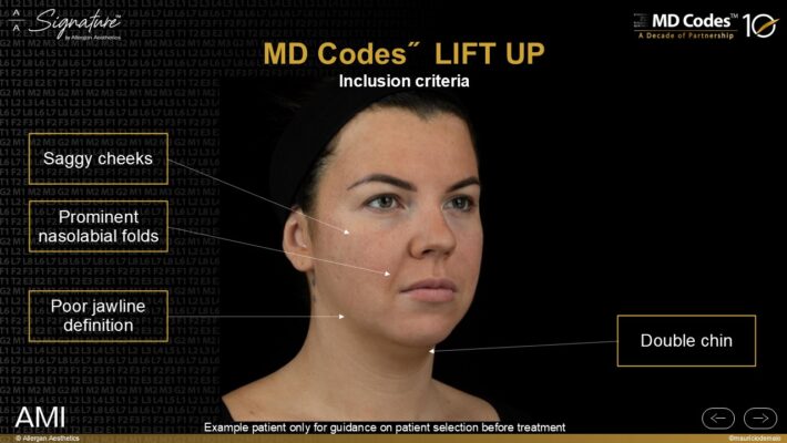 Klinika Oricea brała udział w prestiżowym projekcie firmy Abbvie/Allergan the MD Code Lift Up project.